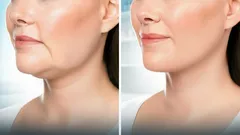 エステティシャンの助けを借りずに「引き締まった顔」を実現する、たった5つの簡単なエクササイズ――わずか数週間で効果が現れます